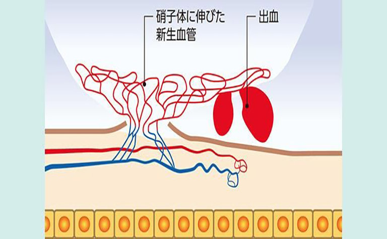 原因