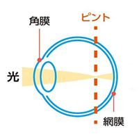 レンズ装用前