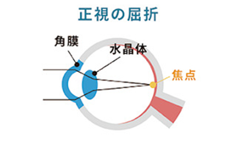 焦点