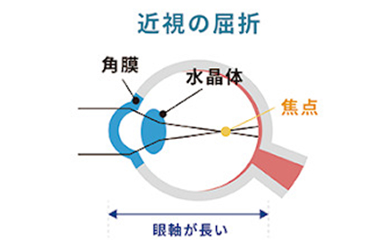 焦点